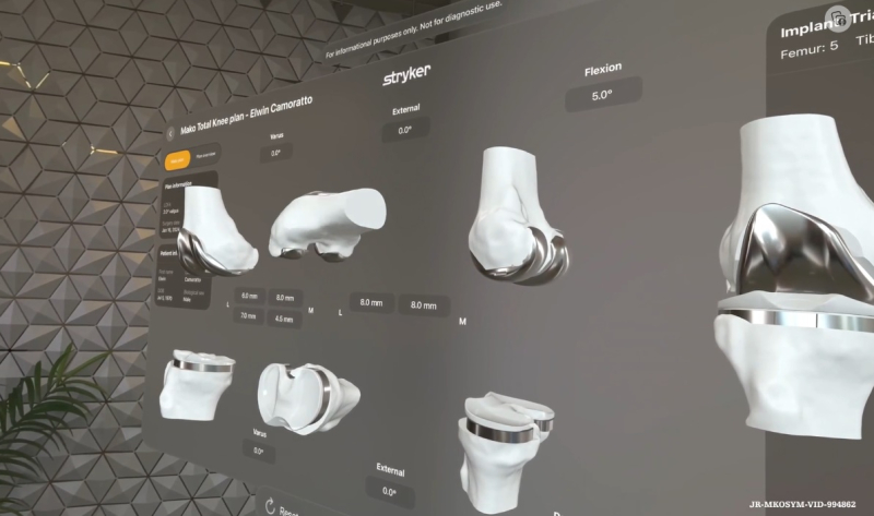 VisionOS expands health app possibilities with Vision Pro image 55 Apple Vision Pro in the healthcare